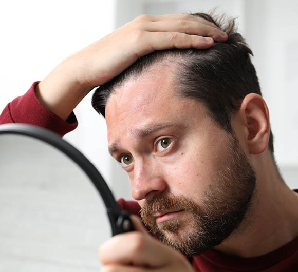 Man with hair loss problem looking at mirror indoors